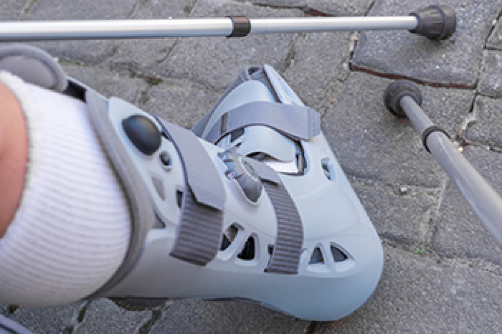 Broken Foot and an Air Cast Boot