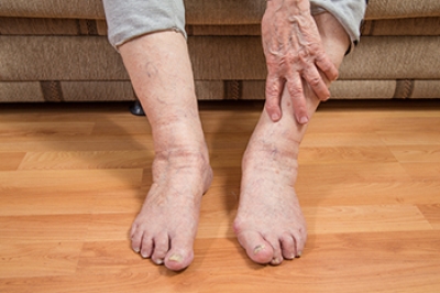 Keeping Senior Feet Healthy and Comfortable